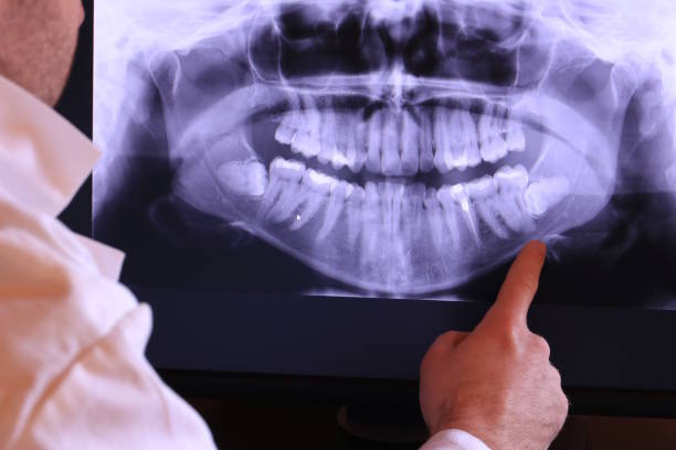 Best Broken or Cracked Tooth Emergency Dentist in Pegram, TN